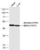 Anti-PPAR alpha (phospho Ser12) antibody used in Western Blot (WB). GTX03713