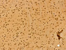 Anti-NCOA6 antibody used in IHC (Paraffin sections) (IHC-P). GTX03716