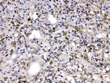 Anti-MMP11 antibody used in IHC (Paraffin sections) (IHC-P). GTX03717