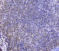 Anti-AHR antibody used in IHC (Paraffin sections) (IHC-P). GTX03719