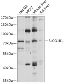 Anti-OATP2 antibody used in Western Blot (WB). GTX03730