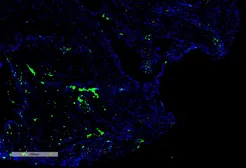 Anti-Citrulline antibody [2D3.1] used in Immunohistochemistry (IHC). GTX03741