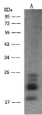 Anti-FGF2 antibody [52] used in Western Blot (WB). GTX03764