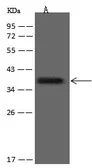 Anti-CD20 antibody [90] used in Western Blot (WB). GTX03768