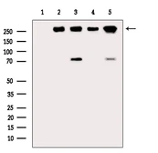 Anti-BRCA2 (phospho Ser2095) antibody used in Western Blot (WB). GTX03783