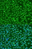 Anti-BRCA1 (phospho Ser1423) antibody used in Immunocytochemistry/ Immunofluorescence (ICC/IF). GTX03784