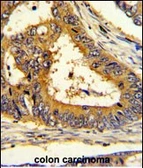 Anti-SCAP antibody used in IHC (Paraffin sections) (IHC-P). GTX03796