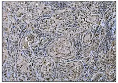 Anti-Fos B antibody used in IHC (Paraffin sections) (IHC-P). GTX03809