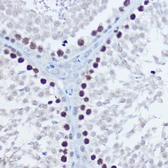 Anti-Aurora B antibody used in IHC (Paraffin sections) (IHC-P). GTX03922