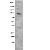 Anti-COL9A1 antibody used in Western Blot (WB). GTX03923