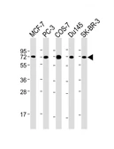 Anti-USP2 antibody [1738CT331.50.87] used in Western Blot (WB). GTX03924