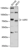 Anti-USP2 antibody used in Western Blot (WB). GTX03925