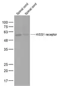 Anti-GPR54 antibody used in Western Blot (WB). GTX03926