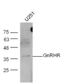 Anti-GnRHR antibody used in Western Blot (WB). GTX03928