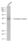Anti-Androgen Receptor antibody used in Western Blot (WB). GTX03929
