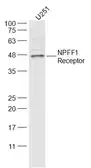 Anti-NPFF1 receptor antibody used in Western Blot (WB). GTX03930
