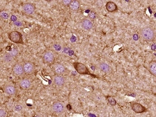Anti-Kiss1 antibody used in IHC (Paraffin sections) (IHC-P). GTX04074