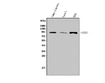 Anti-SOX6 antibody used in Western Blot (WB). GTX04085
