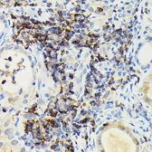 Anti-PI3 kinase p110 gamma antibody used in IHC (Paraffin sections) (IHC-P). GTX04094