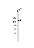 Anti-ATP7b antibody used in Western Blot (WB). GTX04095