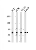 Anti-AMOTL2 antibody used in Western Blot (WB). GTX04100