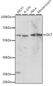Anti-TRP2 antibody used in Western Blot (WB). GTX04101