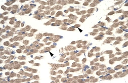 Anti-POU2F3 antibody used in Immunohistochemistry (IHC). GTX04103