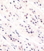 Anti-CDC73 antibody used in IHC (Paraffin sections) (IHC-P). GTX04105