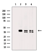 Anti-GNAI1 antibody used in Western Blot (WB). GTX04113