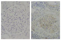 Mouse Anti-Human IgG2 (Fd) antibody [HP6014]. GTX04181