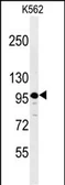 Anti-SE6L2 antibody used in Western Blot (WB). GTX04237