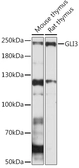 Anti-GLI3 antibody used in Western Blot (WB). GTX04242
