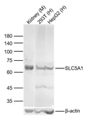 Anti-SGLT1 antibody used in Western Blot (WB). GTX04243