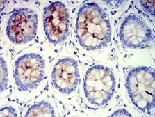 Anti-MUC5B antibody [7F5A1] used in IHC (Paraffin sections) (IHC-P). GTX04248