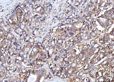 Anti-CD155 antibody [5I13D1] used in IHC (Paraffin sections) (IHC-P). GTX04249