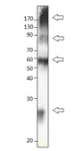 Anti-SLC31A1 / CTR1 antibody used in Western Blot (WB). GTX04251