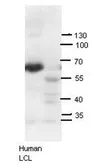 Anti-AIRE antibody used in Western Blot (WB). GTX04257