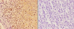 Anti-AIRE antibody used in IHC (Paraffin sections) (IHC-P). GTX04258