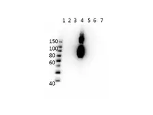 Anti-Hemoglobin beta C antibody [15C2.C11.F2.G11] used in Western Blot (WB). GTX04269