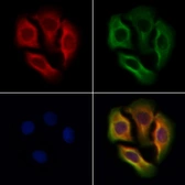 Anti-Glycine Receptor alpha 2 antibody used in Immunocytochemistry/ Immunofluorescence (ICC/IF). GTX04297