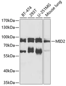Anti-MID2 antibody used in Western Blot (WB). GTX04305