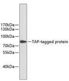 Anti-TAP Tag antibody [AMC0510] used in Western Blot (WB). GTX04310