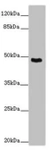 Anti-SMOC1 antibody used in Western Blot (WB). GTX04320