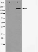 Anti-WNK3 antibody used in Immunocytochemistry/ Immunofluorescence (ICC/IF). GTX04322