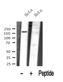 Anti-DEPDC5 antibody used in Western Blot (WB). GTX04326