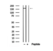 Anti-DEPDC5 (phospho Thr1531) antibody used in Western Blot (WB). GTX04329