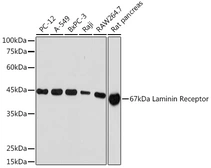 Anti-RPSA antibody [ARC2109] used in Western Blot (WB). GTX04348