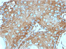 Anti-RPSA antibody [RPSA/2699] used in IHC (Paraffin sections) (IHC-P). GTX04349
