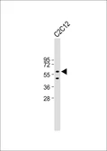 Anti-PAX7 antibody used in Western Blot (WB). GTX04357