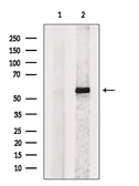 Anti-PAX7 antibody used in Western Blot (WB). GTX04358